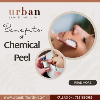 Benefits of chemical peel.
Book your appointment now:
Urban skin & hair clinic.
www.urbanskinhaic