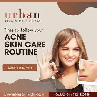Acne-Prone Skin? Here’s How to Identify and Create the Right Routine
Caring for acne-prone skin is 