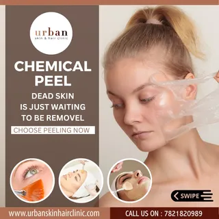 Are you experiencing dull skin, dark spots, sun tanning or pigmentation? Do you wish to get
back yo