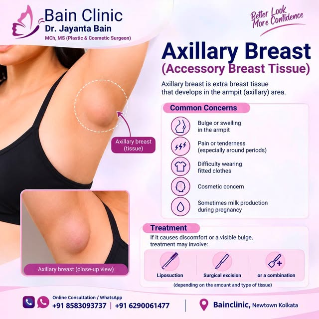Axillary Breast — What is it? 🩷

Axillary breast, also known as accessory breast tissue, is extra b