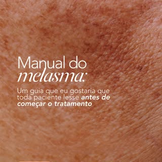 Antes de começar qualquer tratamento para melasma, existem algumas informações que você deveria sabe