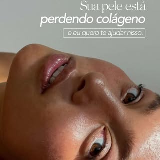 A partir dos 25 anos, começamos a produzir menos colágeno. E, aos poucos, a pele pode ficar menos fi