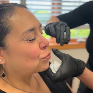 What is a Lip Flip? 💋

A lip flip is a quick, subtle treatment that relaxes the muscles using neuro