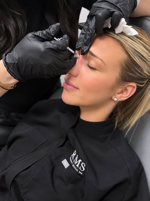 A little filler can make a beautiful difference 💉

Nose filler, also known as a non-surgical rhinop