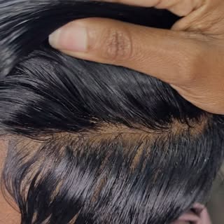 Alopecia Where? 
These nonsurgical Lace Hair Replacements are changing lives!!! (Before styling)
.
.