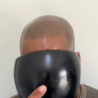 He was sceptical about getting his hairline tattooed too...

But after designing a hairline that fel