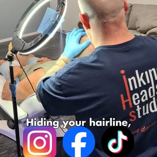 BALDING? WATCH THIS BEFORE YOU SHAVE IT OFF.