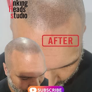 FROM THIS ➡️ TO THIS 🔥

The Inking Heads transformation.

No surgery. No hiding. Just a sharper, mo
