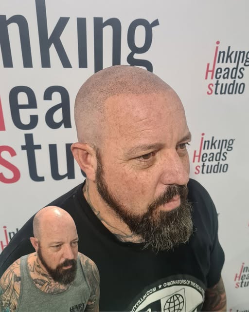FROM THIS ➡️ TO THIS 🔥

The Inking Heads transformation.

No surgery. No hiding. Just a sharper, mo