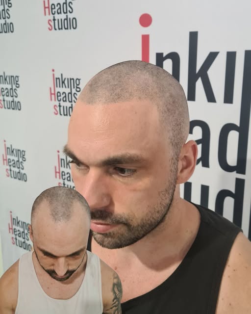 FROM THIS ➡️ TO THIS 🔥

The Inking Heads transformation.

No surgery. No hiding. Just a sharper, mo