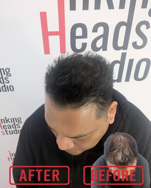**FROM THIS ➡️ TO THIS 🔥**

**The Inking Heads transformation.**

Infill options as well, no need t