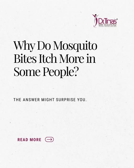 Why do Mosquito bites itch more in some people?
.
.
.
#mysquito#bite#itching#skin#dermat
