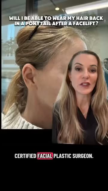 Will I be able to tie my hair back in a ponytail after a facelift? YES!😁 When considering a facelif