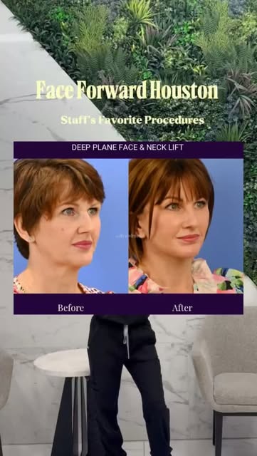 Face Forward Houston team's favorite procedures done by Dr. Rodman.😍

Interested in more informatio