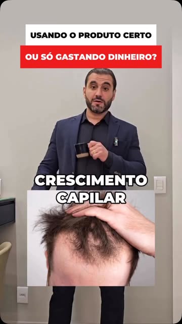 Usando o produto certo para o seu cabelo? 

Siga @dr.pedropublio 

#transplantecapilar #cabelo #calv
