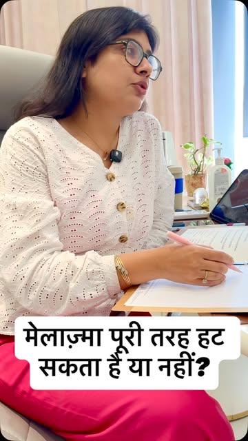 ✨ क्या मेलाज़्मा पूरी तरह हट सकता है? ✨
मेलाज़्मा एक आम लेकिन जिद्दी pigmentation की समस्या है। सही 