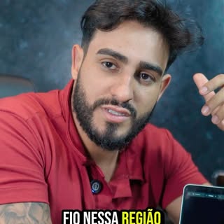 Você sabia sobre o transplante de redução de testa? Comenta aqui 👇🏼👀
