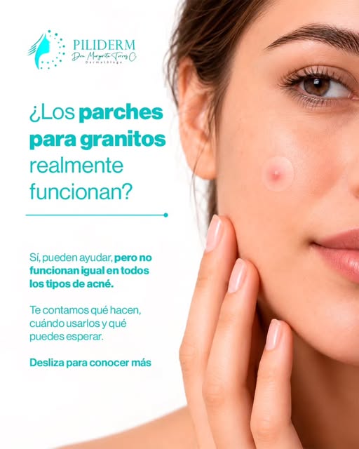 ✨ ¿Los parches para granitos realmente funcionan? Sí, pero no en todos los tipos de acné. 🩵

Los pa