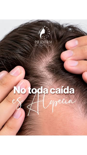 🧴💇‍♀️ ¿Ves mucho cabello en tu cepillo y ya piensas que te estás quedando sin pelo? 😰

¡No te ala