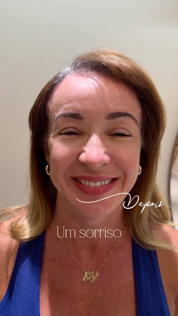Mulher faz transplante capilar? 🤔

Sim. E talvez você não saiba disso.

A alopecia de padrão femini