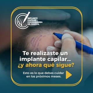 El éxito de un implante capilar también depende de los cuidados posteriores. 🌱

Seguir las recomend
