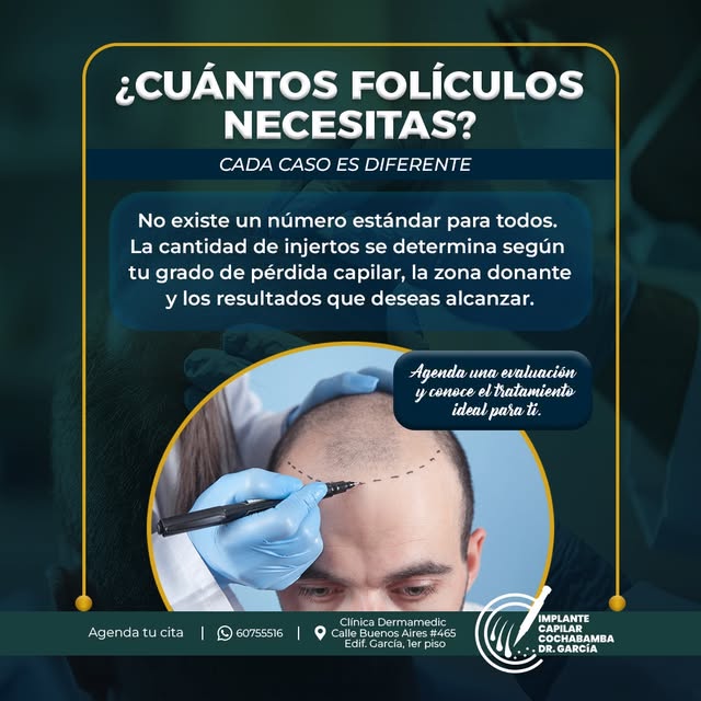 🔹 No se trata de colocar más, sino de colocar lo necesario.

La planificación de un implante capila