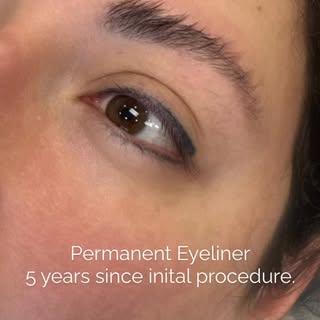 5 years after the initial procedure → freshly defined again ✨

Permanent eyeliner is designed to fad