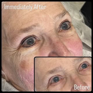 ✨ Wondering if permanent eyeliner is still an option for you? ✨

One of the questions we hear most o