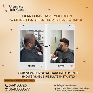 Tired of waiting for your hair to grow back? 
Our non-surgical hair treatments deliver visible resul