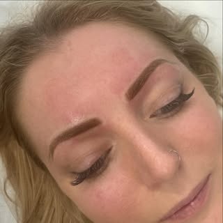 A stunning powder brows transformation 😍
Redness can happen and will go down within 30mins 
Colour 