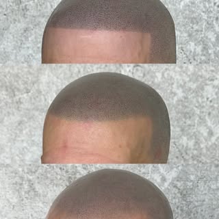 CHOOSE YOUR HAIRLINE: Sharp • Soft • Natural

Every client’s style, face shape, and goals are differ