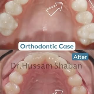 #alnoordentalcenter #rak#rasalkhaimah #uae#insta #Rak#dubie #rakdentis #orthopedics #تجميل #تجميل_نس