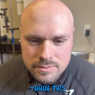 SMP will never die - Unlike a transplant, you have GUARANTEED results (when you choose the right pro