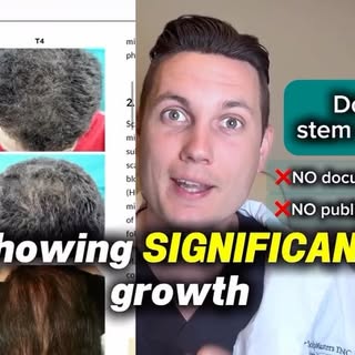 ARC Therapy easily beats #prp, #stemcell, and #exosomes. This is why.