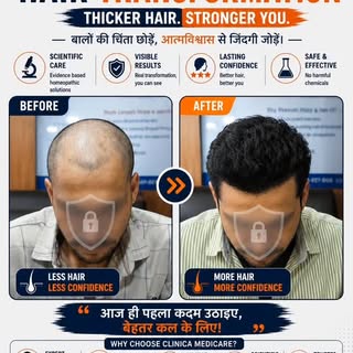 Before and After, visible transformation 👇
Confidence wapas paaye – scientifically guided care ke s