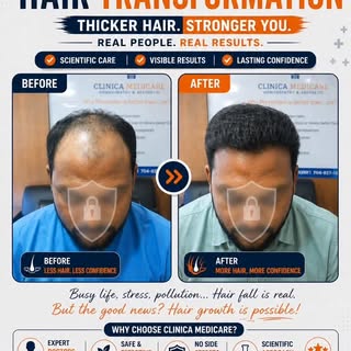 Before / After , visible transformation 👇
Confidence wapas paaye –  scientifically guided care ke s