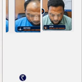 Before / After , visible transformation 👇
Confidence wapas paaye – scientifically guided care ke sa