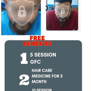 #Before / #After visible #Hair transformation 👇
Confidence wapas paaye – scientifically guided care