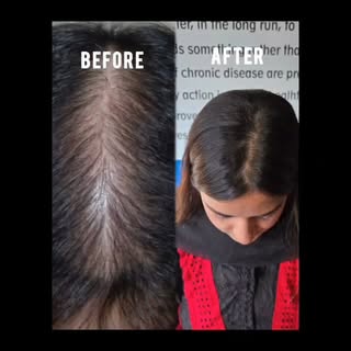 Before / After , visible transformation 👇
Confidence wapas paaye – scientifically guided care ke sa