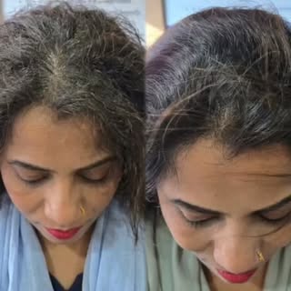 Before / After , visible transformation 
Confidence wapas paaye – scientifically guided care ke saat