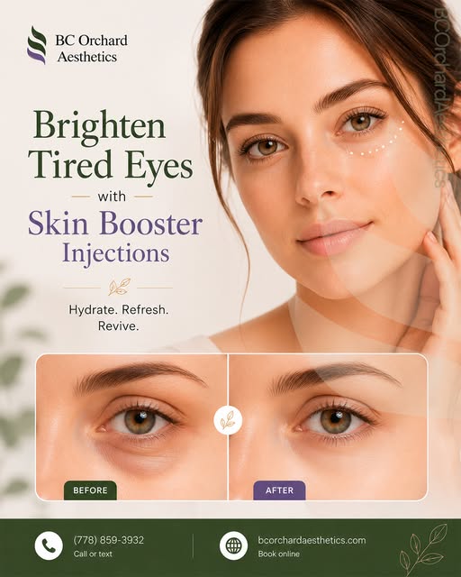 Under-eye skin booster injections deliver hyaluronic acid directly beneath the thin skin around the 
