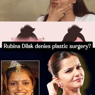 Rubina Dilak denies Plastic Surgery??
What do you think is she natural or not?

Disclaimer : This co