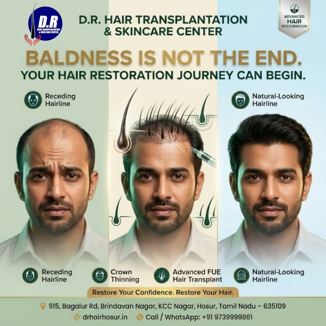 ✨ BALDNESS IS NOT THE END. YOUR HAIR RESTORATION JOURNEY CAN BEGIN. ✨

Hair loss can gradually chang