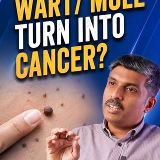 Not every black spot on the skin is something to fear.

Warts, moles and other skin lesions may look