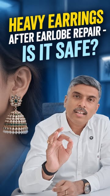 Got your earlobe repaired? Don’t let heavy earrings undo the result. 👂✨

After an earlobe repair, l