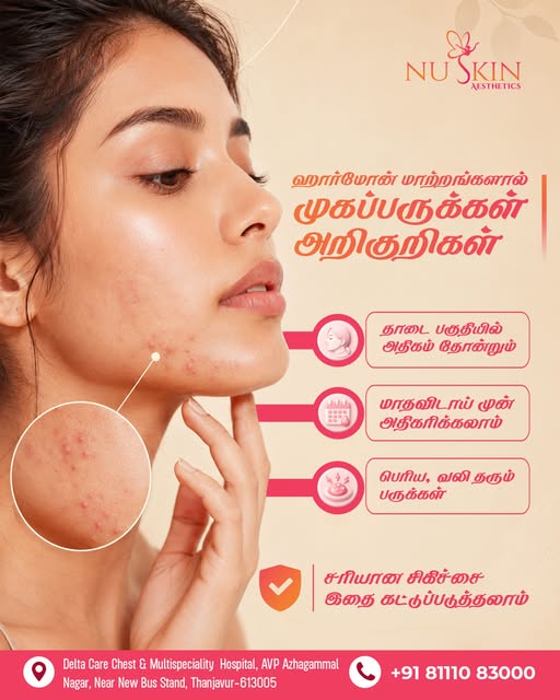 Hormonal acne can be more than just a few pimples.

If you notice acne that keeps coming back, espec