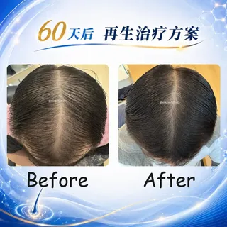 60天，头发可以有什么改变？

当你还在犹豫，
有人已经开始行动。

今天分享一位帅气中年男士的真实案例。👇

其实早在20多岁接近30岁时，理发师就提醒他：
「顶部好像开始变稀疏了。」

当时年轻