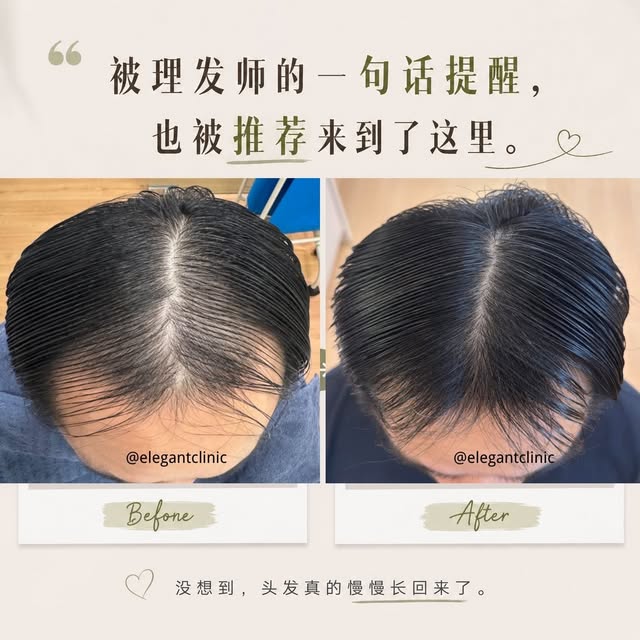这位顾客，其实也是因为理发师的推荐，才来到我们这里的。✂️

因为我们就在附近，所以平时也有不少顾客会去同一间理发店剪头发。

慢慢的，理发师就发现一个很有趣的现象——
诶？为什么这些顾客的头发，好像