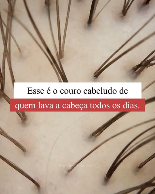 Muita gente ainda acha que lavar o cabelo com frequência "resseca" ou "prejudica". Na prática, é o c