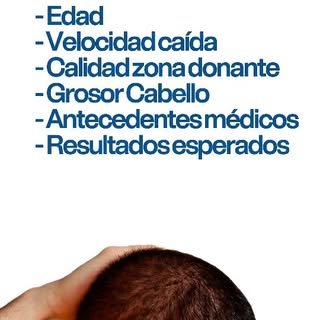 Dos pacientes pueden tener una pérdida de cabello similar, pero eso no significa que necesiten el mi